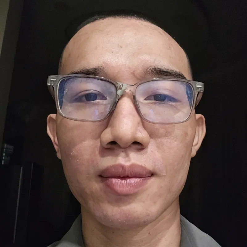 Tính Acid Vlogs